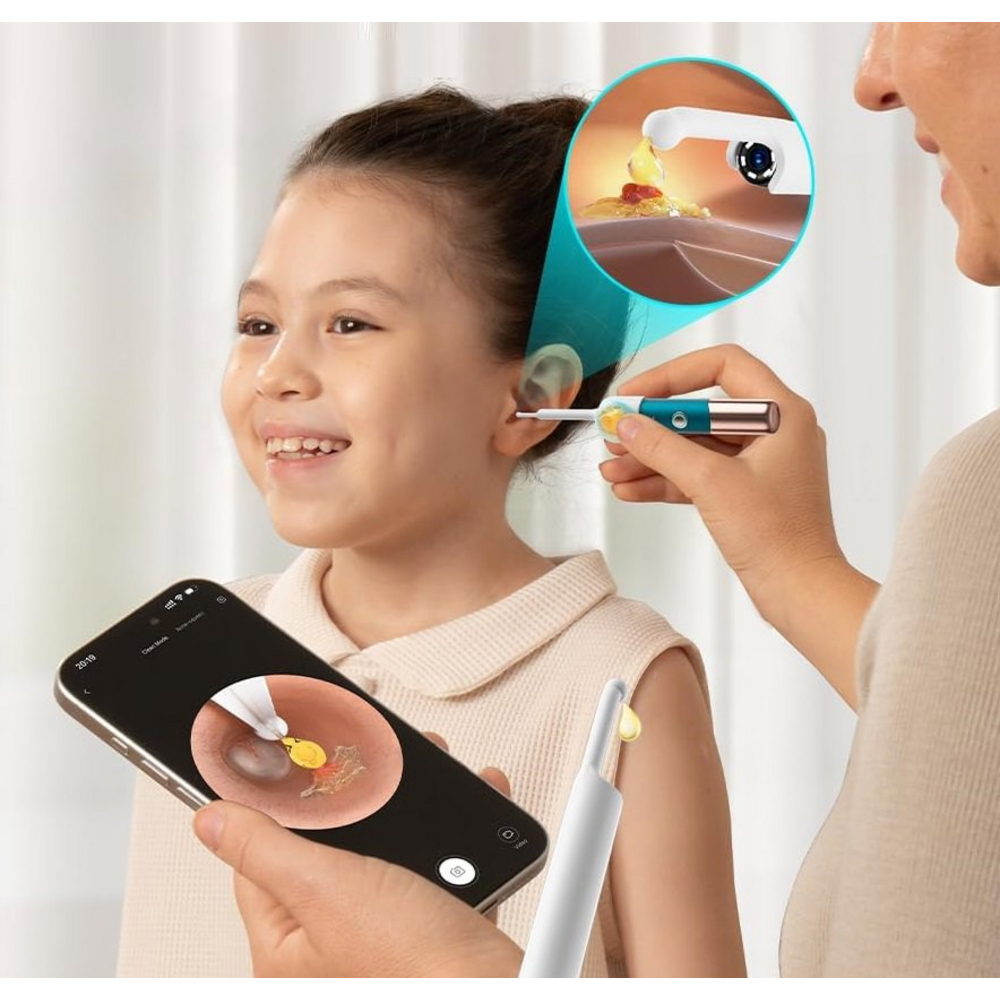 Použití Bebird Earsight Ultra při kontrole ucha dítěte