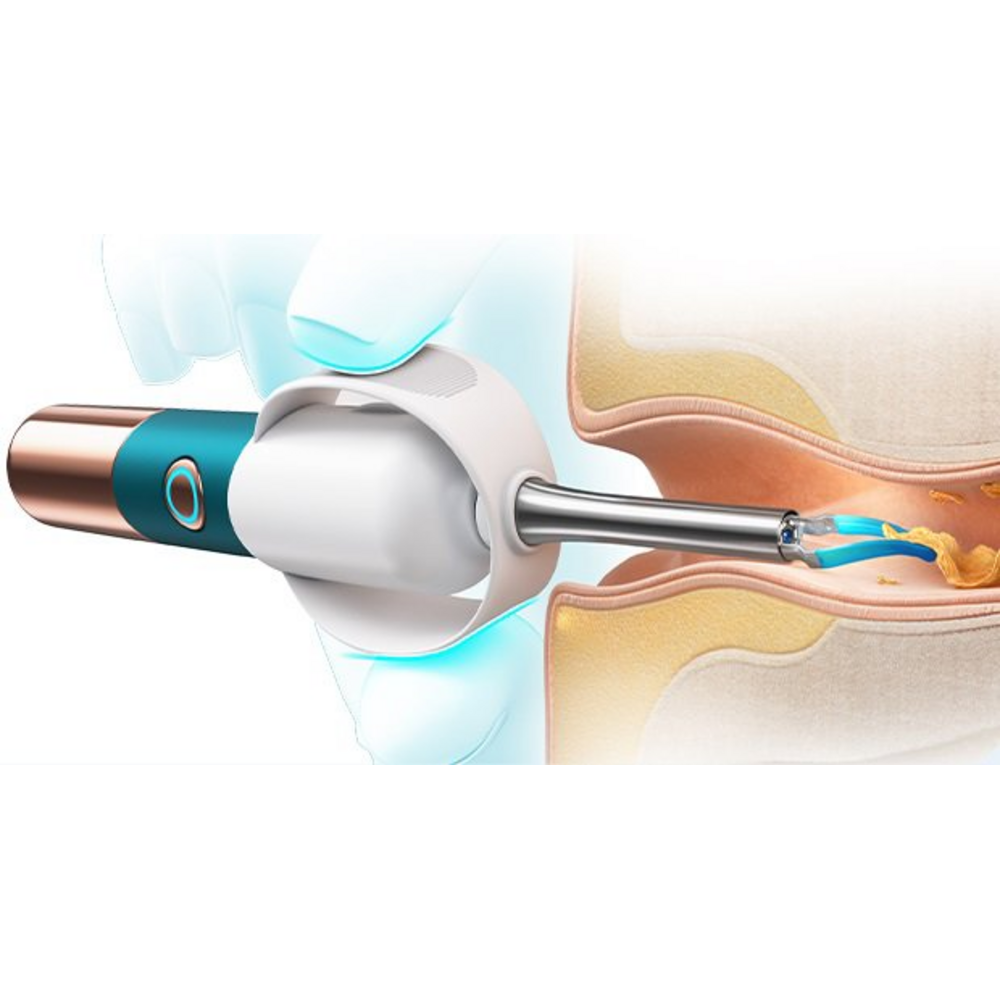 Flexibilní micro-tube Bebird Earsight Ultra uvnitř zvukovodu