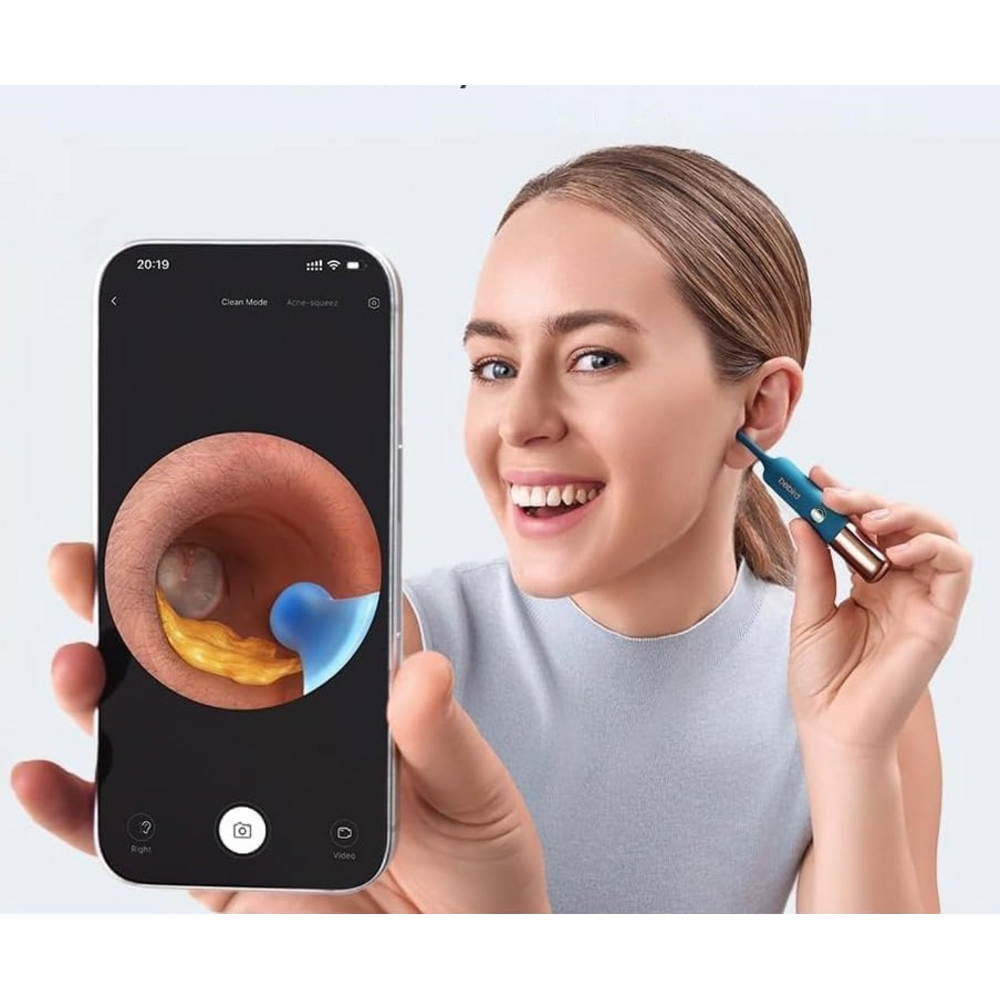 Bebird Earsight Ultra při živé vizuální kontrole ucha