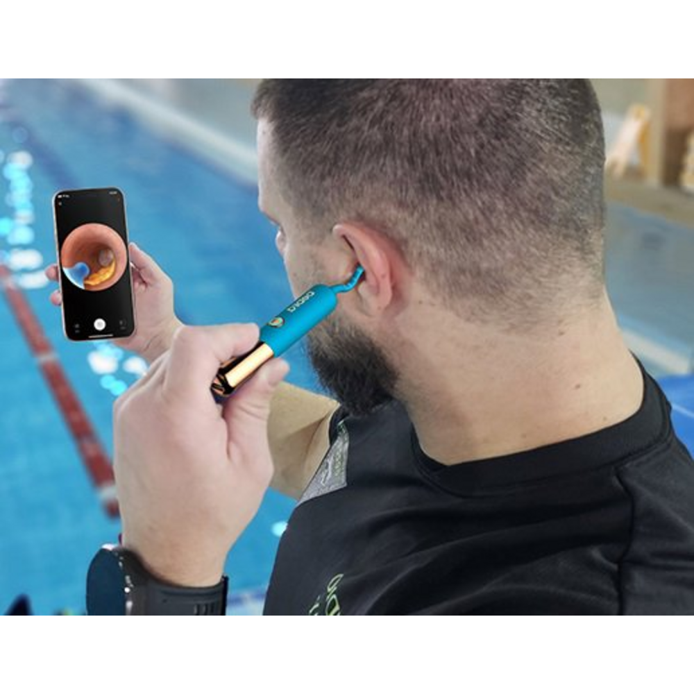 Kompletní sada nástavců a tipů Bebird Earsight Ultra
